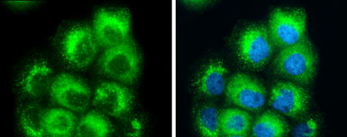 Anti-RAB7A antibody used in Immunocytochemistry/ Immunofluorescence (ICC/IF). GTX132548