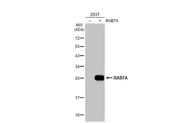 Anti-RAB7A antibody used in Western Blot (WB). GTX132548