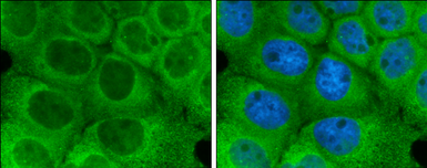 Anti-Optineurin antibody used in Immunocytochemistry/ Immunofluorescence (ICC/IF). GTX132575