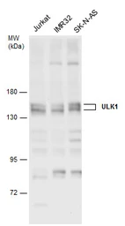 Anti-ULK1 antibody used in Western Blot (WB). GTX132669