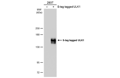 Anti-ULK1 antibody used in Western Blot (WB). GTX132669