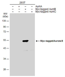 Anti-Aurora B antibody used in Western Blot (WB). GTX132702