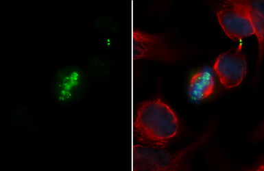 Anti-Aurora B antibody used in Immunocytochemistry/ Immunofluorescence (ICC/IF). GTX132702