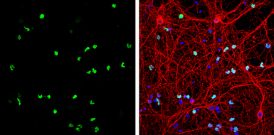 Anti-OLIG2 antibody used in Immunocytochemistry/ Immunofluorescence (ICC/IF). GTX132732