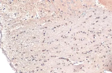 Anti-OLIG2 antibody used in IHC (Paraffin sections) (IHC-P). GTX132732