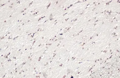 Anti-OLIG2 antibody used in IHC (Paraffin sections) (IHC-P). GTX132732