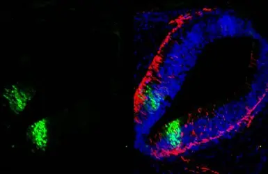 Anti-OLIG2 antibody used in IHC (Paraffin sections) (IHC-P). GTX132732