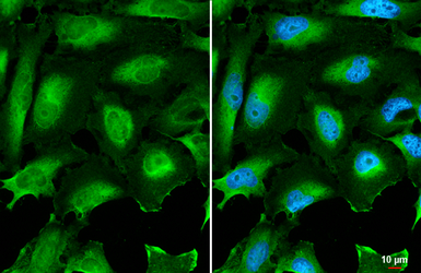 Anti-CD59 antibody used in Immunocytochemistry/ Immunofluorescence (ICC/IF). GTX132874