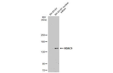 Anti-HDAC9 antibody used in Western Blot (WB). GTX132949