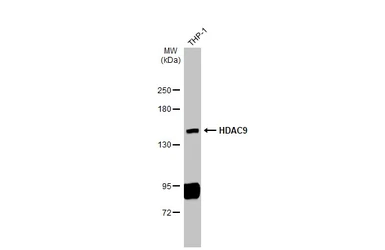 Anti-HDAC9 antibody used in Western Blot (WB). GTX132949