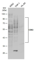 Anti-CD63 antibody used in Western Blot (WB). GTX132953