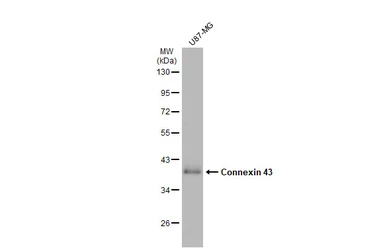 Anti-Connexin 43 antibody used in Western Blot (WB). GTX133022