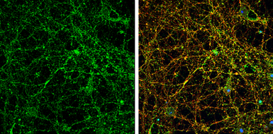 Anti-PSD95 antibody used in Immunocytochemistry/ Immunofluorescence (ICC/IF). GTX133091