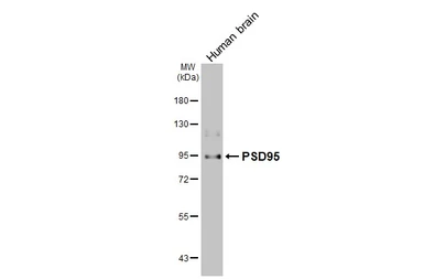 Anti-PSD95 antibody used in Western Blot (WB). GTX133091