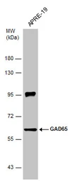 Anti-GAD65 antibody used in Western Blot (WB). GTX133096