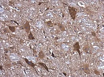 Anti-NMDAR1 antibody used in IHC (Paraffin sections) (IHC-P). GTX133097