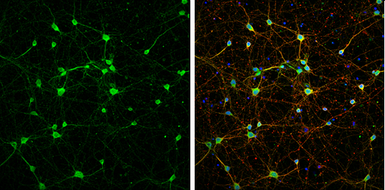 Anti-NMDAR1 antibody used in Immunocytochemistry/ Immunofluorescence (ICC/IF). GTX133097