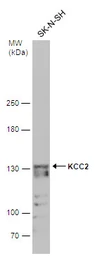 Anti-KCC2 antibody used in Western Blot (WB). GTX133130