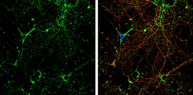 Anti-KCC2 antibody used in Immunocytochemistry/ Immunofluorescence (ICC/IF). GTX133130