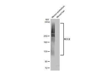 Anti-KCC2 antibody used in Western Blot (WB). GTX133130