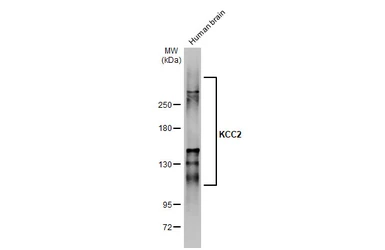 Anti-KCC2 antibody used in Western Blot (WB). GTX133130