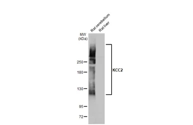 Anti-KCC2 antibody used in Western Blot (WB). GTX133130