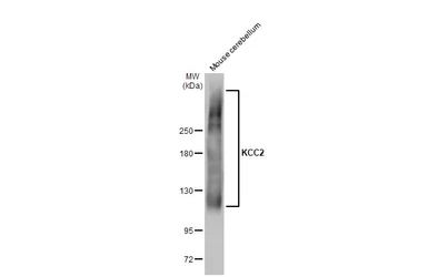 Anti-KCC2 antibody used in Western Blot (WB). GTX133130