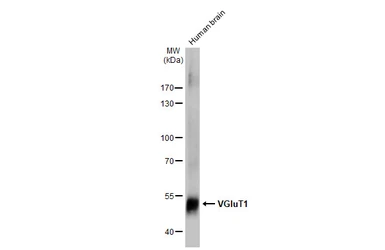 Anti-VGluT1 antibody used in Western Blot (WB). GTX133148