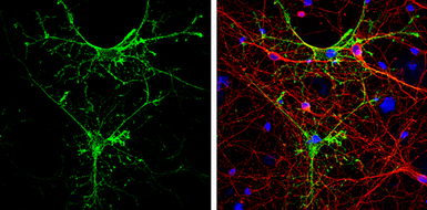 Anti-Aquaporin 4 antibody used in Immunocytochemistry/ Immunofluorescence (ICC/IF). GTX133151