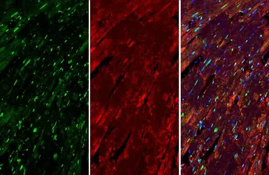 Anti-Nkx2.5 antibody used in IHC (Paraffin sections) (IHC-P). GTX133155