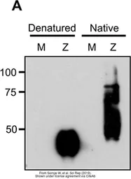 Anti-Zika virus NS1 protein antibody used in Western Blot (WB). GTX133307