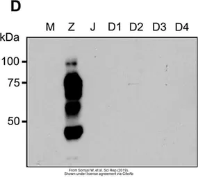 Anti-Zika virus NS1 protein antibody used in Western Blot (WB). GTX133307