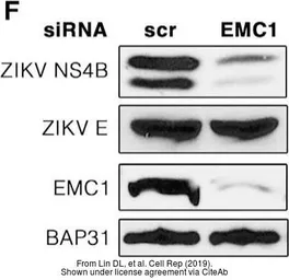 Anti-Zika virus NS4B protein antibody used in Western Blot (WB). GTX133311