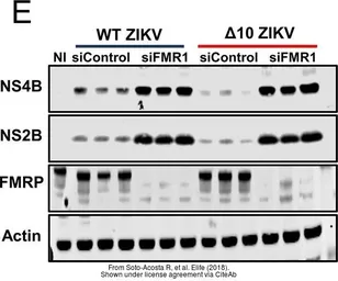 Anti-Zika virus NS4B protein antibody used in Western Blot (WB). GTX133321