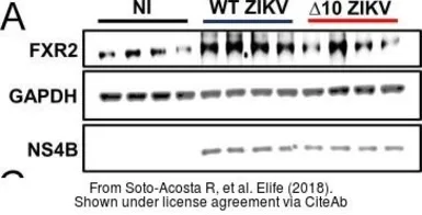 Anti-Zika virus NS4B protein antibody used in Western Blot (WB). GTX133321