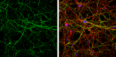 Anti-alpha Internexin antibody used in Immunocytochemistry/ Immunofluorescence (ICC/IF). GTX133356