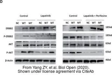 Anti-Her2 / ErbB2 (phospho Tyr1248) antibody used in Western Blot (WB). GTX133439