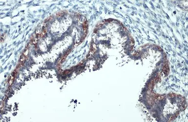 Anti-Her2 / ErbB2 (phospho Tyr1248) antibody used in IHC (Paraffin sections) (IHC-P). GTX133439