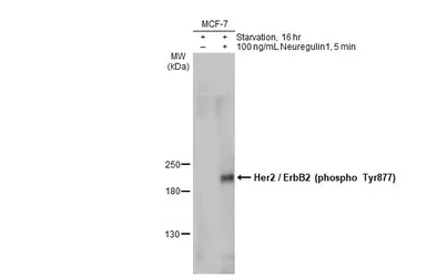 Anti-Her2 / ErbB2 (phospho Tyr877) antibody used in Western Blot (WB). GTX133443