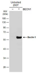 Anti-Beclin 1 antibody used in Western Blot (WB). GTX133555