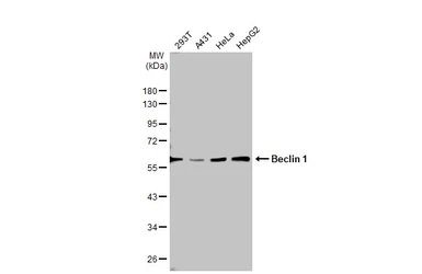 Anti-Beclin 1 antibody used in Western Blot (WB). GTX133555