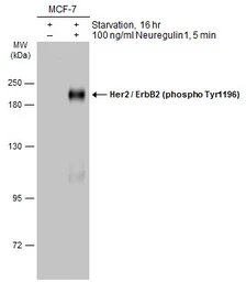 Anti-Her2 / ErbB2 (phospho Tyr1196) antibody used in Western Blot (WB). GTX133602