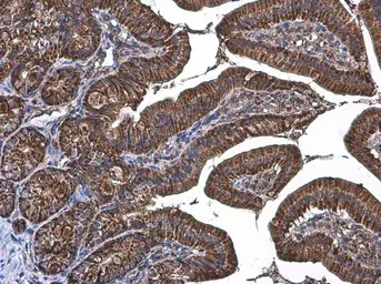 Anti-TOMM20 antibody used in IHC (Paraffin sections) (IHC-P). GTX133756