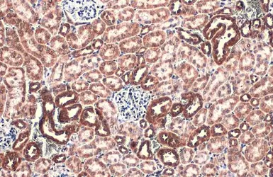 Anti-TOMM20 antibody used in IHC (Paraffin sections) (IHC-P). GTX133756