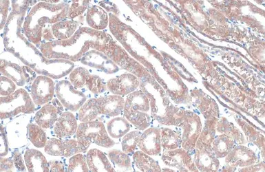 Anti-TOMM20 antibody used in IHC (Paraffin sections) (IHC-P). GTX133756