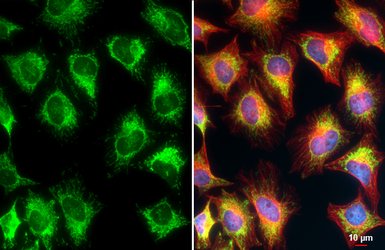 Anti-TOMM20 antibody used in Immunocytochemistry/ Immunofluorescence (ICC/IF). GTX133756