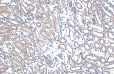 Anti-TOMM20 antibody used in IHC (Paraffin sections) (IHC-P). GTX133756