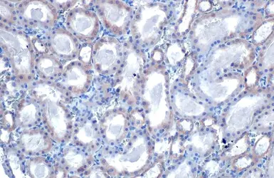 Anti-TOMM20 antibody used in IHC (Paraffin sections) (IHC-P). GTX133756