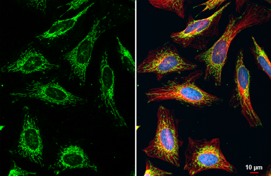 Anti-TOMM20 antibody used in Immunocytochemistry/ Immunofluorescence (ICC/IF). GTX133756