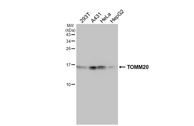 Anti-TOMM20 antibody used in Western Blot (WB). GTX133756